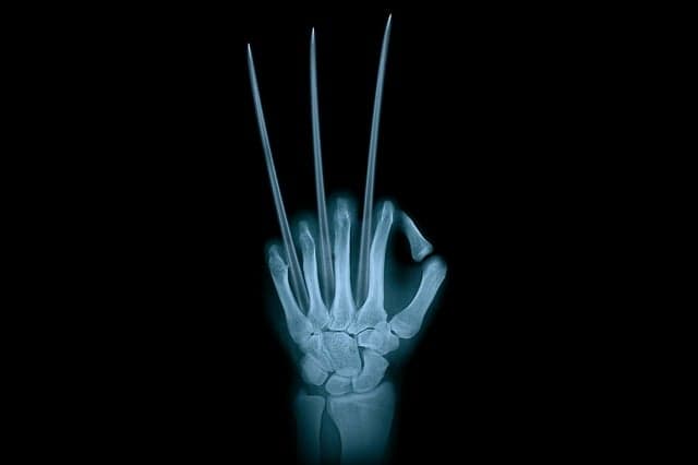 hand